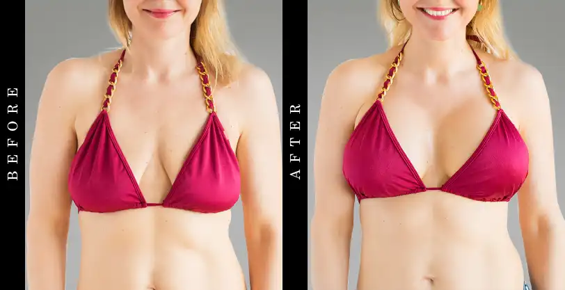 Total Curve Before and After